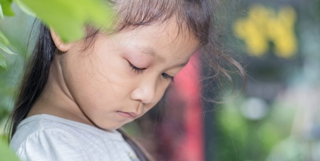 Что делать, если вас ужалила в глаз пчела?
