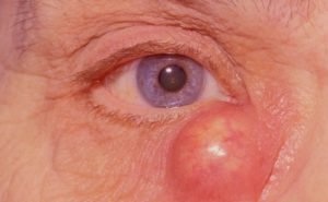 Почему у меня щиплет глаза?
