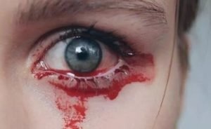 Почему глаза кровоточат
