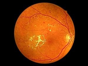 Список заболеваний глаз у человека - описание симптомов
