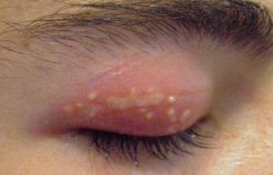 Холод в твоих глазах
