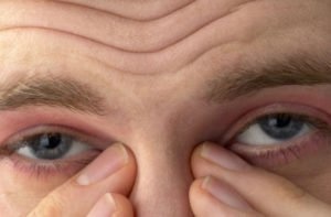 Почему у меня щиплет глаза?
