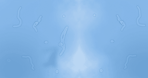 Миодезопсия или 