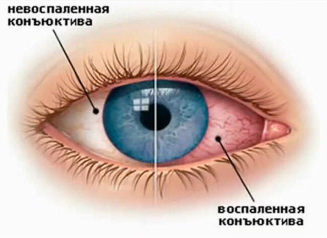 выжженный солнцем глаз