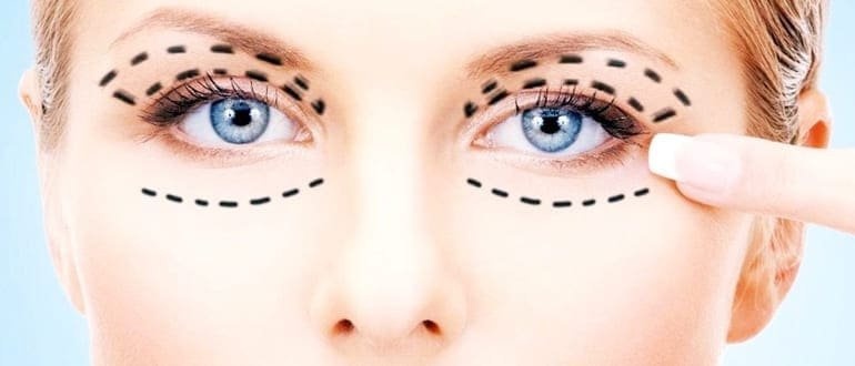 Как быстро уменьшить отечность под глазами
