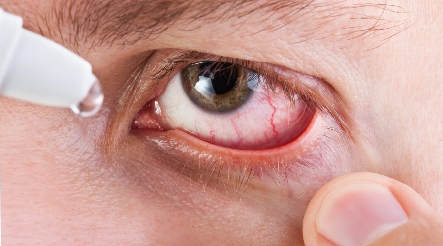 Почему лопаются кровеносные сосуды?
